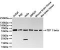 Western Blot
Positive WB detected in: Jurkat whole cell lysate(30µg) ,Raji whole cell lysate(30µg) , Hela whole cell lysate(30µg) , SW620 whole cell lysate(30µg) ,Mouse brain tissue lysate(30µg) ,Rat brain tissue lysate(30µg) 
All lanes: TCP 1 beta antibody at 1:1000
Secondary
Goat polyclonal to rabbit IgG at 1/40000 dilution
Predicted band size: 57 kDa
Observed band size: 57 kDa
Exposure time：1min