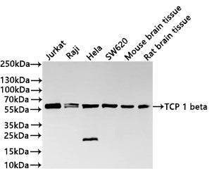 Western Blot
Positive WB detected in: Jurkat whole cell lysate(30µg) ,Raji whole cell lysate(30µg) , Hela whole cell lysate(30µg) , SW620 whole cell lysate(30µg) ,Mouse brain tissue lysate(30µg) ,Rat brain tissue lysate(30µg) 
All lanes: TCP 1 beta antibody at 1:1000
Secondary
Goat polyclonal to rabbit IgG at 1/40000 dilution
Predicted band size: 57 kDa
Observed band size: 57 kDa
Exposure time：1min