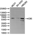 Western Blot
Positive WB detected in: MCF7 whole cell lysate(30µg), SH-SY5Y whole cell lysate(30µg), HEK293 whole cell lysate(30µg)
All lanes:CBS antibody at 1:1000
Secondary
Goat polyclonal to rabbit IgG at 1/40000 dilution
Predicted band size: 61 kDa
Observed band size: 61 kDa
Exposure time：2min