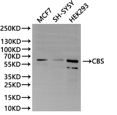 Western Blot
Positive WB detected in: MCF7 whole cell lysate(30µg), SH-SY5Y whole cell lysate(30µg), HEK293 whole cell lysate(30µg)
All lanes:CBS antibody at 1:1000
Secondary
Goat polyclonal to rabbit IgG at 1/40000 dilution
Predicted band size: 61 kDa
Observed band size: 61 kDa
Exposure time：2min