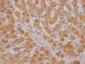 IHC image of CSB-RA242969A0HU diluted at 1:100 and staining in paraffin-embedded human liver tissue performed on a Leica BondTM system. After dewaxing and hydration, antigen retrieval was mediated by high pressure in a citrate buffer (pH 6.0) . Section was blocked with 10% normal goat serum 30min at RT. Then primary antibody (1% BSA) was incubated at 4℃ overnight. The primary is detected by a Goat anti-rabbit IgG polymer labeled by HRP and visualized using 0.05% DAB.
