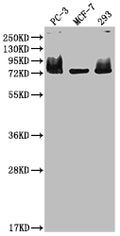 Western Blot
Positive WB detected in: PC-3 whole cell lysate, MCF-7 whole cell lysate, 293 whole cell lysate
All lanes: MEN1 antibody at 1:2000
Secondary
Goat polyclonal to rabbit IgG at 1/50000 dilution
Predicted band size: 69, 68, 64 kDa
Observed band size: 75 kDa