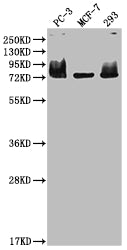 Western Blot
Positive WB detected in: PC-3 whole cell lysate, MCF-7 whole cell lysate, 293 whole cell lysate
All lanes: MEN1 antibody at 1:2000
Secondary
Goat polyclonal to rabbit IgG at 1/50000 dilution
Predicted band size: 69, 68, 64 kDa
Observed band size: 75 kDa