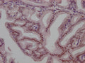 IHC image of CSB-RA243116A0HU diluted at 1:100 and staining in paraffin-embedded human prostate tissue performed on a Leica BondTM system. After dewaxing and hydration, antigen retrieval was mediated by high pressure in a citrate buffer (pH 6.0) . Section was blocked with 10% normal goat serum 30min at RT. Then primary antibody (1% BSA) was incubated at 4℃ overnight. The primary is detected by a Goat anti-rabbit IgG polymer labeled by HRP and visualized using 0.05% DAB.