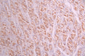 IHC image of CSB-RA243394A0HU diluted at 1:100 and staining in paraffin-embedded human stomach tissue performed on a Leica BondTM system. After dewaxing and hydration, antigen retrieval was mediated by high pressure in a citrate buffer (pH 6.0) . Section was blocked with 10% normal goat serum 30min at RT. Then primary antibody (1% BSA) was incubated at 4°C overnight. The primary is detected by a Goat anti-rabbit polymer IgG labeled by HRP and visualized using 0.05% DAB.