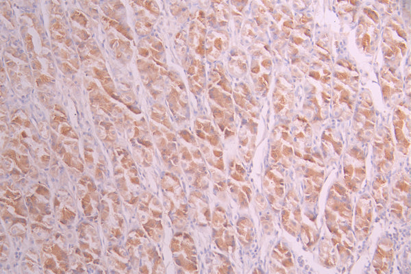 IHC image of CSB-RA243394A0HU diluted at 1:100 and staining in paraffin-embedded human stomach tissue performed on a Leica BondTM system. After dewaxing and hydration, antigen retrieval was mediated by high pressure in a citrate buffer (pH 6.0) . Section was blocked with 10% normal goat serum 30min at RT. Then primary antibody (1% BSA) was incubated at 4°C overnight. The primary is detected by a Goat anti-rabbit polymer IgG labeled by HRP and visualized using 0.05% DAB.
