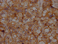 CDH2 Antibody – Figure 1 of 1