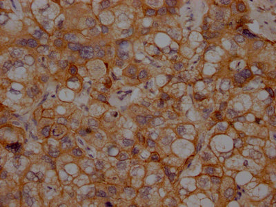 CDH2 Antibody – Figure 1 of 1