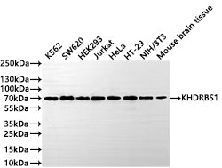 Western Blot
Positive WB detected in: K562 whole cell lysate(30µg) , SW620 whole cell lysate(30µg) , HEK293 whole cell lysate(30µg) , Jurkat whole cell lysate(30µg) , HeLa whole cell lysate(30µg) , HT-29 whole cell lysate(30µg) , NIH/3T3 whole cell lysate(30µg) , Mouse brain tissue lysate(30µg) 
All lanes: KHDRBS1 antibody at 1:1000
Secondary
Goat polyclonal to rabbit IgG at 1/50000 dilution
Predicted band size: 48 kDa
Observed band size: 68 kDa
Exposure time: 1min
