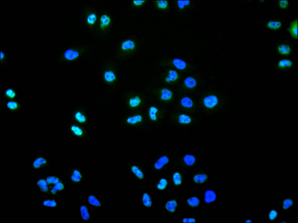 Immunofluorescence staining of HeLa cell with CSB-RA244708A0HU at 1:50 , counter-stained with DAPI. The cells were fixed in 4% formaldehyde, permeabilized using 0.2% Triton X-100 and blocked in 10% normal Goat Serum. The cells were then incubated with the antibody overnight at 4°C. The secondary antibody was Alexa Fluor 488-congugated AffiniPure Goat Anti-Rabbit IgG(H+L).