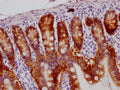 IHC image of CSB-RA245537A0HU diluted at 1:100 and staining in paraffin-embedded human small intestine tissue performed on a Leica BondTM system. After dewaxing and hydration, antigen retrieval was mediated by high pressure in a citrate buffer (pH 6.0) . Section was blocked with 10% normal goat serum 30min at RT. Then primary antibody (1% BSA) was incubated at 4℃ overnight. The primary is detected by a Goat anti-rabbit IgG polymer labeled by HRP and visualized using 0.05% DAB.