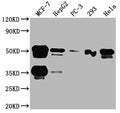 Western Blot
Positive WB detected in: MCF-7 whole cell lysate, HepG2 whole cell lysate, PC-3 whole cell lysate, 293 whole cell lysate, Hela whole cell lysate
All lanes: FOXA1 antibody at 1:2000
Secondary
Goat polyclonal to rabbit IgG at 1/50000 dilution
Predicted band size: 50, 46 kDa
Observed band size: 50 kDa