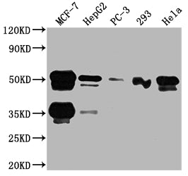 Western Blot
Positive WB detected in: MCF-7 whole cell lysate, HepG2 whole cell lysate, PC-3 whole cell lysate, 293 whole cell lysate, Hela whole cell lysate
All lanes: FOXA1 antibody at 1:2000
Secondary
Goat polyclonal to rabbit IgG at 1/50000 dilution
Predicted band size: 50, 46 kDa
Observed band size: 50 kDa
