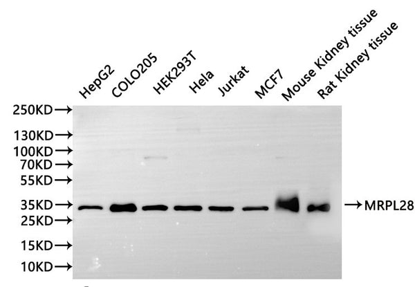 Western Blot, 
Positive WB detected in:HepG2 whole cell lysate(30µg), COLO205 whole cell lysate(30µg), HEK293T whole cell lysate(30µg), Hela whole cell lysate(30µg), Jurkat whole cell lysate(30µg), MCF7 whole cell lysate(30µg), Mouse kidney tissue lysate(30µg), Rat kidney tissue lysate(30µg)
All lanes: CtBP2 antibody at 1:1000
Secondary
Goat polyclonal to rabbit IgG at 1/40000 dilution
Predicted band size: 49 kDa
Observed band size: 49 kDa
Exposure time：10s