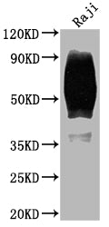 Western Blot
Positive WB detected in: Raji whole cell lysate
All lanes: CD80 antibody at 1:2000
Secondary
Goat polyclonal to rabbit IgG at 1/50000 dilution
Predicted band size: 34, 30, 19 kDa
Observed band size: 60 kDa