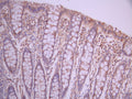 IHC image of CSB-RA246457A0HU diluted at 1:100 and staining in paraffin-embedded human small intestine tissue performed on a Leica BondTM system. After dewaxing and hydration, antigen retrieval was mediated by high pressure in a citrate buffer (pH 6.0). Section was blocked with 10% normal goat serum 30min at RT. Then primary antibody (1% BSA) was incubated at 4°C overnight. The primary is detected by a Goat anti-rabbit polymer IgG labeled by HRP and visualized using 0.05% DAB.