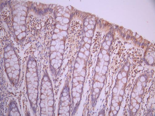 IHC image of CSB-RA246457A0HU diluted at 1:100 and staining in paraffin-embedded human small intestine tissue performed on a Leica BondTM system. After dewaxing and hydration, antigen retrieval was mediated by high pressure in a citrate buffer (pH 6.0). Section was blocked with 10% normal goat serum 30min at RT. Then primary antibody (1% BSA) was incubated at 4°C overnight. The primary is detected by a Goat anti-rabbit polymer IgG labeled by HRP and visualized using 0.05% DAB.