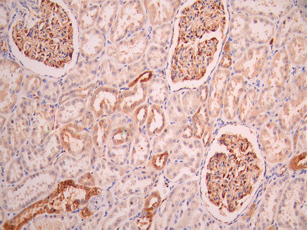 IHC image of CSB-RA247067A0HU diluted at 1:100 and staining in paraffin-embedded human kidney tissue performed on a Leica BondTM system. After dewaxing and hydration, antigen retrieval was mediated by high pressure in a citrate buffer (pH 6.0). Section was blocked with 10% normal goat serum 30min at RT. Then primary antibody (1% BSA) was incubated at 4°C overnight. The primary is detected by a Goat anti-rabbit polymer IgG labeled by HRP and visualized using 0.05% DAB.