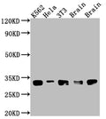 Western Blot
Positive WB detected in: K562 whole cell lysate, Hela whole cell lysate, NIH/3T3 whole cell lysate, Rat Brain whole cell lysate, Mouse Brain whole cell lysate
All lanes: Bcl-XL antibody at 1:1000
Secondary
Goat polyclonal to rabbit IgG at 1/50000 dilution
Predicted band size: 27, 19, 26 kDa
Observed band size: 30 kDa