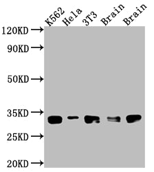 Western Blot
Positive WB detected in: K562 whole cell lysate, Hela whole cell lysate, NIH/3T3 whole cell lysate, Rat Brain whole cell lysate, Mouse Brain whole cell lysate
All lanes: Bcl-XL antibody at 1:1000
Secondary
Goat polyclonal to rabbit IgG at 1/50000 dilution
Predicted band size: 27, 19, 26 kDa
Observed band size: 30 kDa