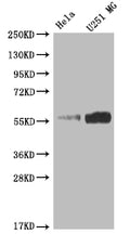 Western Blot
Positive WB detected in: Hela whole cell lysate, U251 whole cell lysate
All lanes: NUF2 antibody at 1:2000
Secondary
Goat polyclonal to rabbit IgG at 1/50000 dilution
Predicted band size: 55 kDa
Observed band size: 55 kDa
