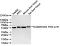 Western Blot
Positive WB detected in: HepG2 whole cell lysate(30µg) , A375 whole cell lysate(30µg) , Mouse liver tissue lysate(30µg) , Rat liver tissue lysate(30µg) 
All lanes: Cytochrome P450 27A1 antibody at 1:1000
Secondary
Goat polyclonal to rabbit IgG at 1/40000 dilution
Predicted band size: 60 kDa
Observed band size: 55 kDa
Exposure time：40s