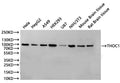 Western Blot
Positive WB detected in: Hela whole cell lysate(30µg), HepG2 whole cell lysate(30µg), A549 whole cell lysate(30µg), HEK293 whole cell lysate(30µg), U-87MG whole cell lysate(30µg), NIH/3T3 whole cell lysate(30µg), Mouse brain tissue lysate(30µg), Rat brain tissue lysate(30µg)
All lanes: THOC1 antibody at 1:1000
Secondary
Goat polyclonal to rabbit IgG at 1/40000 dilution
Predicted band size: 76 kDa
Observed band size: 100 kDa
Exposure time：2min