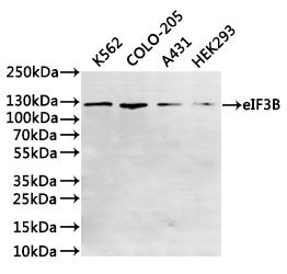 Western Blot, 
Positive WB detected in:K562 whole cell lysate(30µg), COLO-205 whole cell lysate(30µg), A431 whole cell lysate(30µg), HEK293 whole cell lysate(30µg)
All lanes: eIF3B antibody at 1:1000
Secondary
Goat polyclonal to rabbit IgG at 1/40000 dilution
Predicted band size: 92 kDa
Observed band size: 116 kDa
Exposure time：1min