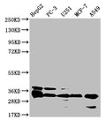 Western Blot
Positive WB detected in: HepG2 whole cell lysate, PC-3 whole cell lysate, U251 whole cell lysate, MCF-7 whole cell lysate, A549 whole cell lysate
All lanes: TMEM192 antibody at 1:1000
Secondary
Goat polyclonal to rabbit IgG at 1/50000 dilution
Predicted band size: 31 kDa
Observed band size: 31 kDa