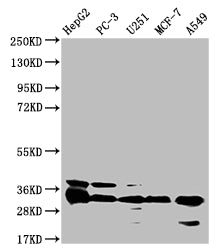 Western Blot
Positive WB detected in: HepG2 whole cell lysate, PC-3 whole cell lysate, U251 whole cell lysate, MCF-7 whole cell lysate, A549 whole cell lysate
All lanes: TMEM192 antibody at 1:1000
Secondary
Goat polyclonal to rabbit IgG at 1/50000 dilution
Predicted band size: 31 kDa
Observed band size: 31 kDa