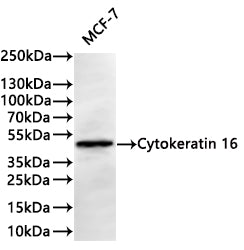 Western Blot
Positive WB detected in: MCF-7 whole cell lysate(30µg) 
All lanes:Cytokeratin 16 antibody at 1:1000
Secondary
Goat polyclonal to rabbit IgG at 1/40000 dilution
Predicted band size: 51 kDa
Observed band size: 51 kDa
Exposure time：1min40s