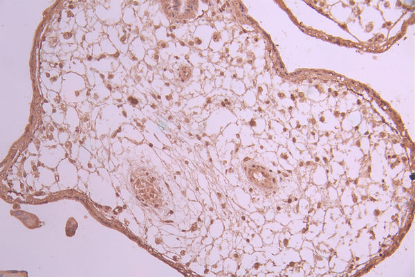 IHC image of CSB-RA250534A0HU diluted at 1:100 and staining in paraffin-embedded human placenta tissue performed on a Leica BondTM system. After dewaxing and hydration, antigen retrieval was mediated by high pressure in a citrate buffer (pH 6.0) . Section was blocked with 10% normal goat serum 30min at RT. Then primary antibody (1% BSA) was incubated at 4°C overnight. The primary is detected by a Goat anti-rabbit polymer IgG labeled by HRP and visualized using 0.05% DAB.
