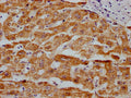 MAOA Antibody – Figure 1 of 3