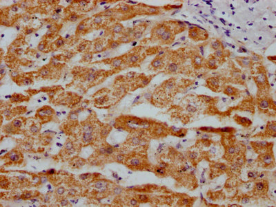 MAOA Antibody – Figure 1 of 3