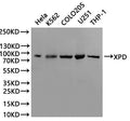 Western Blot
Positive WB detected in: Hela whole cell lysate(30µg), K562 whole cell lysate(30µg), COLO205 whole cell lysate(30µg), U251 whole cell lysate(30µg), THP-1 whole cell lysate(30µg)
All lanes: XPD binding protein 1 antibody at 1:1000
Secondary
Goat polyclonal to rabbit IgG at 1/40000 dilution
Predicted band size: 87 kDa
Observed band size: 87 kDa
Exposure time：2min