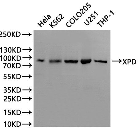 Western Blot
Positive WB detected in: Hela whole cell lysate(30µg), K562 whole cell lysate(30µg), COLO205 whole cell lysate(30µg), U251 whole cell lysate(30µg), THP-1 whole cell lysate(30µg)
All lanes: XPD binding protein 1 antibody at 1:1000
Secondary
Goat polyclonal to rabbit IgG at 1/40000 dilution
Predicted band size: 87 kDa
Observed band size: 87 kDa
Exposure time：2min