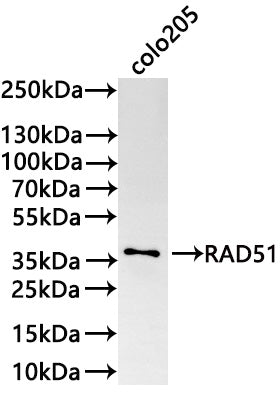 Western Blot
Positive WB detected in: COLO205 whole cell lysate(30µg) 
All lanes: RAD51 antibody at 1:1000
Secondary
Goat polyclonal to rabbit IgG at 1/50000 dilution
Predicted band size: 37 kDa
Observed band size: 37 kDa
Exposure time: 3min