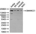 Western Blot, 
Positive WB detected in: Jurkat whole cell lysate(30µg), SH-SY5Y whole cell lysate(30µg), colo205 whole cell lysate(30µg), A431 whole cell lysate(30µg)
All lanes: SMARCC1 antibody at 1:1000
Secondary
Goat polyclonal to rabbit IgG at 1/40000 dilution
Predicted band size: 123 kDa
Observed band size: 155 kDa
Exposure time：120s