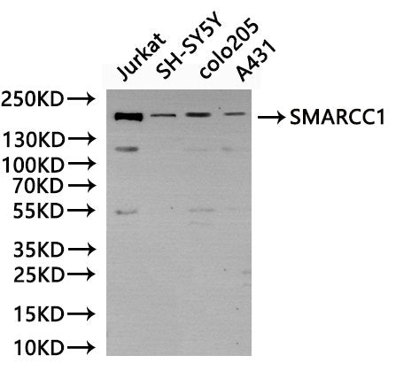 Western Blot, 
Positive WB detected in: Jurkat whole cell lysate(30µg), SH-SY5Y whole cell lysate(30µg), colo205 whole cell lysate(30µg), A431 whole cell lysate(30µg)
All lanes: SMARCC1 antibody at 1:1000
Secondary
Goat polyclonal to rabbit IgG at 1/40000 dilution
Predicted band size: 123 kDa
Observed band size: 155 kDa
Exposure time：120s
