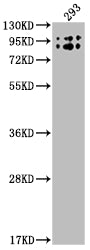 Western Blot
Positive WB detected in: 293 whole cell lysate
All lanes: BCHE antibody at 1:2000
Secondary
Goat polyclonal to rabbit IgG at 1/50000 dilution
Predicted band size: 69 kDa
Observed band size: 90 kDa