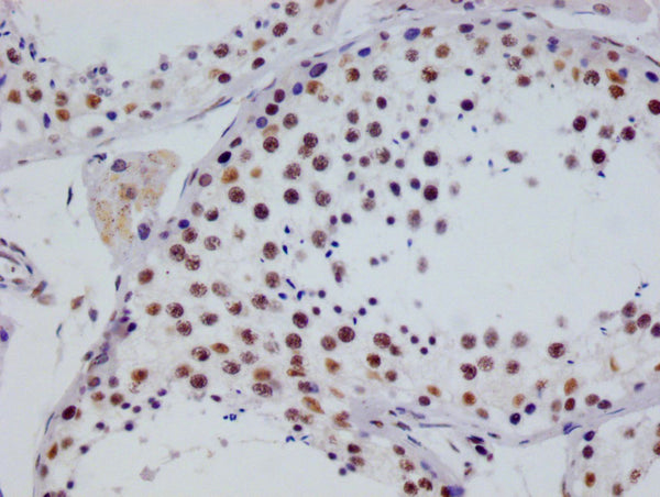IHC image of CSB-RA253226A0HU diluted at 1:100 and staining in paraffin-embedded human testis tissue performed on a Leica BondTM system. After dewaxing and hydration, antigen retrieval was mediated by high pressure in a citrate buffer (pH 6.0) . Section was blocked with 10% normal goat serum 30min at RT. Then primary antibody (1% BSA) was incubated at 4°C overnight. The primary is detected by a Goat anti-rabbit polymer IgG labeled by HRP and visualized using 0.05% DAB.