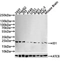 Western Blot
Positive WB detected in: 293T whole cell lysate, Hela whole cell lysate, HepG2 whole cell lysate 293 whole cell lysate, A549 whole cell lysate, U-251 whole cell lysate, Mouse Brain whole cell lysate
All lanes: Id1 antibody at 1:1000
Secondary
Goat polyclonal to rabbit IgG at 1/50000 dilution
Predicted band size: 17, 16 kDa
Observed band size: 26 kDa