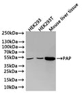 Western Blot
Positive WB detected in: HEK293 whole cell lysate(30µg), HEK293T whole cell lysate(30µg), Mouse liver tissue lysate(30µg)
All lanes: PAP antibody at 1:1000
Secondary
Goat polyclonal to rabbit IgG at 1/40000 dilution
Predicted band size: 45 kDa
Observed band size: 45 kDa
Exposure time：3min