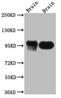 Western Blot
Positive WB detected in: Rat Brain whole cell lysate, Mouse Brain whole cell lysate
All lanes: PSD95 antibody at 1:1000
Secondary
Goat polyclonal to rabbit IgG at 1/50000 dilution
Predicted band size: 81, 86, 81 kDa
Observed band size: 95 kDa