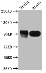 Western Blot
Positive WB detected in: Rat Brain whole cell lysate, Mouse Brain whole cell lysate
All lanes: PSD95 antibody at 1:1000
Secondary
Goat polyclonal to rabbit IgG at 1/50000 dilution
Predicted band size: 81, 86, 81 kDa
Observed band size: 95 kDa