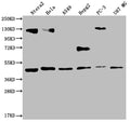 Western Blot
Positive WB detected in: Ntera-2 whole cell lysate, Hela whole cell lysate, A549 whole cell lysate, HepG2 whole cell lysate, PC3 whole cell lysate, U87 whole cell lysate
All lanes: HIF1AN antibody at 1:2000
Secondary
Goat polyclonal to rabbit IgG at 1/50000 dilution
Predicted band size: 41 kDa
Observed band size: 36-53 kDa