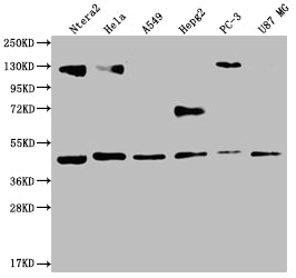 Western Blot
Positive WB detected in: Ntera-2 whole cell lysate, Hela whole cell lysate, A549 whole cell lysate, HepG2 whole cell lysate, PC3 whole cell lysate, U87 whole cell lysate
All lanes: HIF1AN antibody at 1:2000
Secondary
Goat polyclonal to rabbit IgG at 1/50000 dilution
Predicted band size: 41 kDa
Observed band size: 36-53 kDa