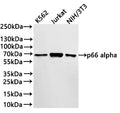 Western Blot
Positive WB detected in:K562 whole cell lysate(30µg) , Jurkat whole cell lysate(30µg) , NIH/3T3 whole cell lysate(30µg) 
All lanes: p66 alpha antibody at 1:1000
Secondary
Goat polyclonal to rabbit IgG at 1/40000 dilution
Predicted band size: 68 kDa
Observed band size: 68 kDa
Exposure time：1min