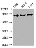 Western Blot
Positive WB detected in: K562 whole cell lysate, MCF-7 whole cell lysate, U251 whole cell lysate
All lanes: IKK beta antibody at 1:2000
Secondary
Goat polyclonal to rabbit IgG at 1/50000 dilution
Predicted band size: 87 kDa
Observed band size: 87 kDa