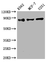 Western Blot
Positive WB detected in: K562 whole cell lysate, MCF-7 whole cell lysate, U251 whole cell lysate
All lanes: IKK beta antibody at 1:2000
Secondary
Goat polyclonal to rabbit IgG at 1/50000 dilution
Predicted band size: 87 kDa
Observed band size: 87 kDa